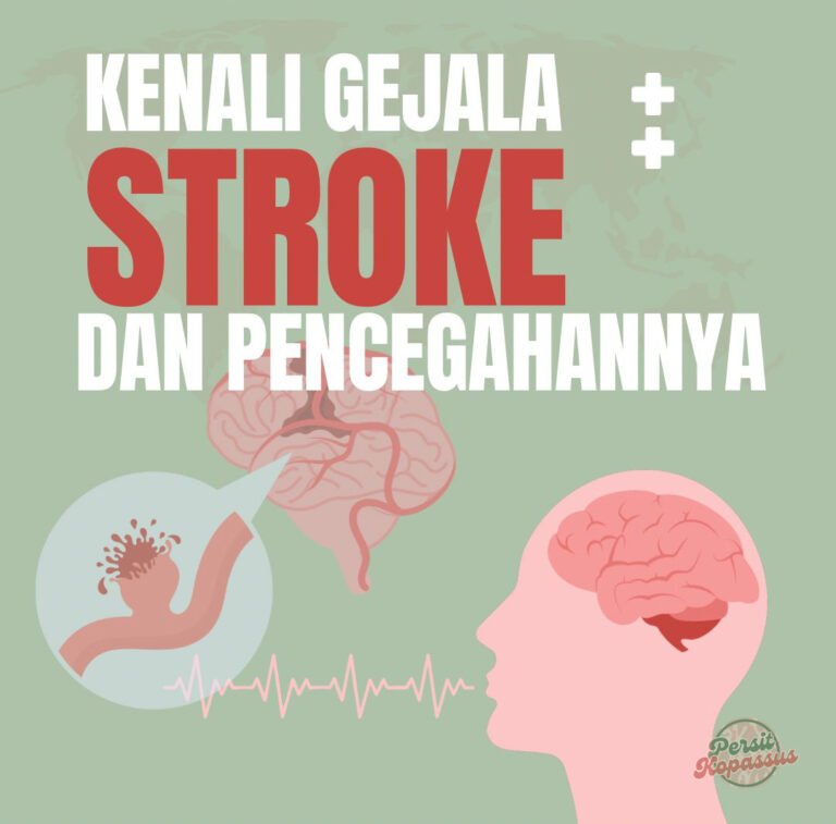 Kenali Gejala Stroke dan Cara Pencegahan